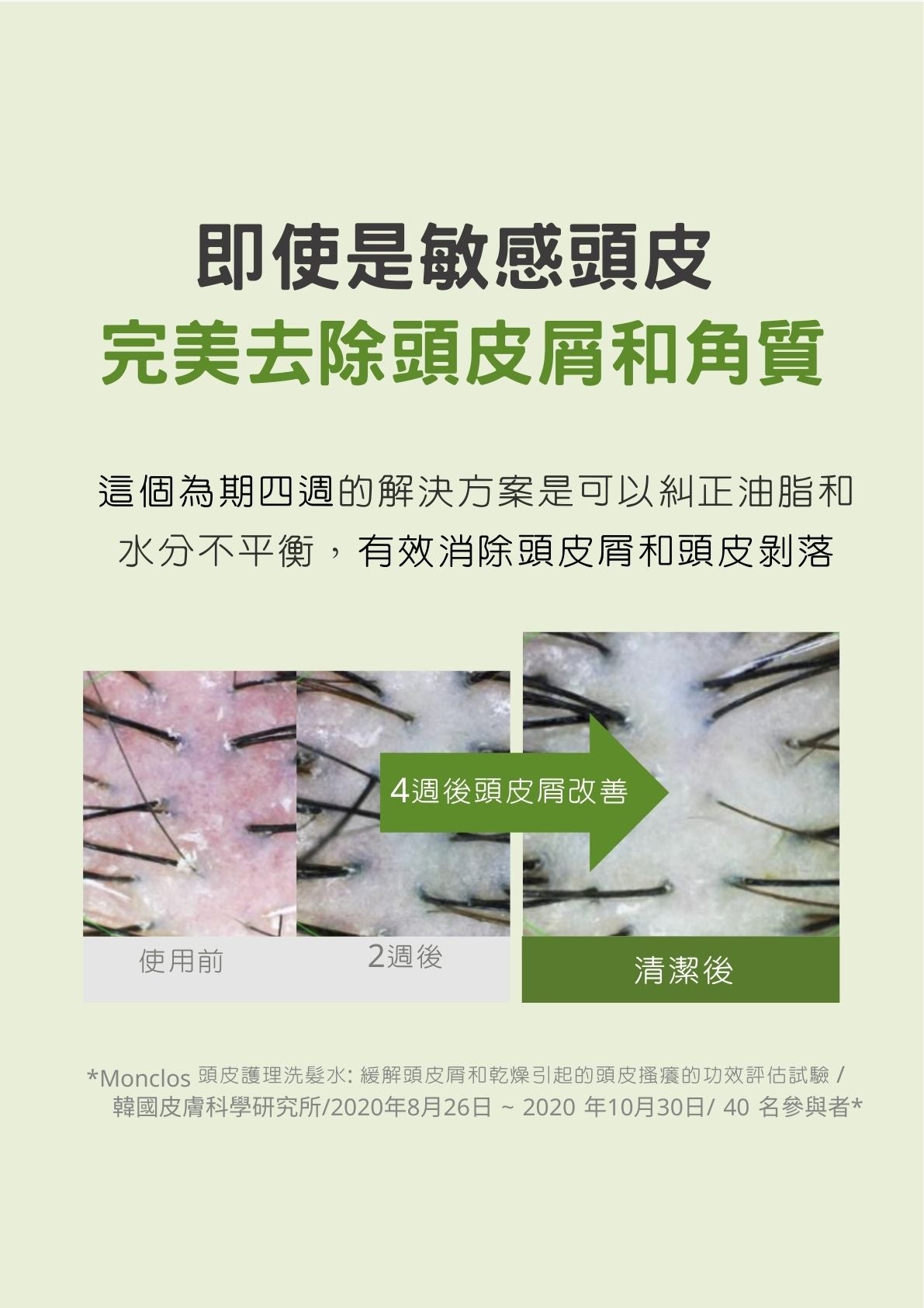 MONCLOS頭皮護理洗髮水500ml (香港總代理)